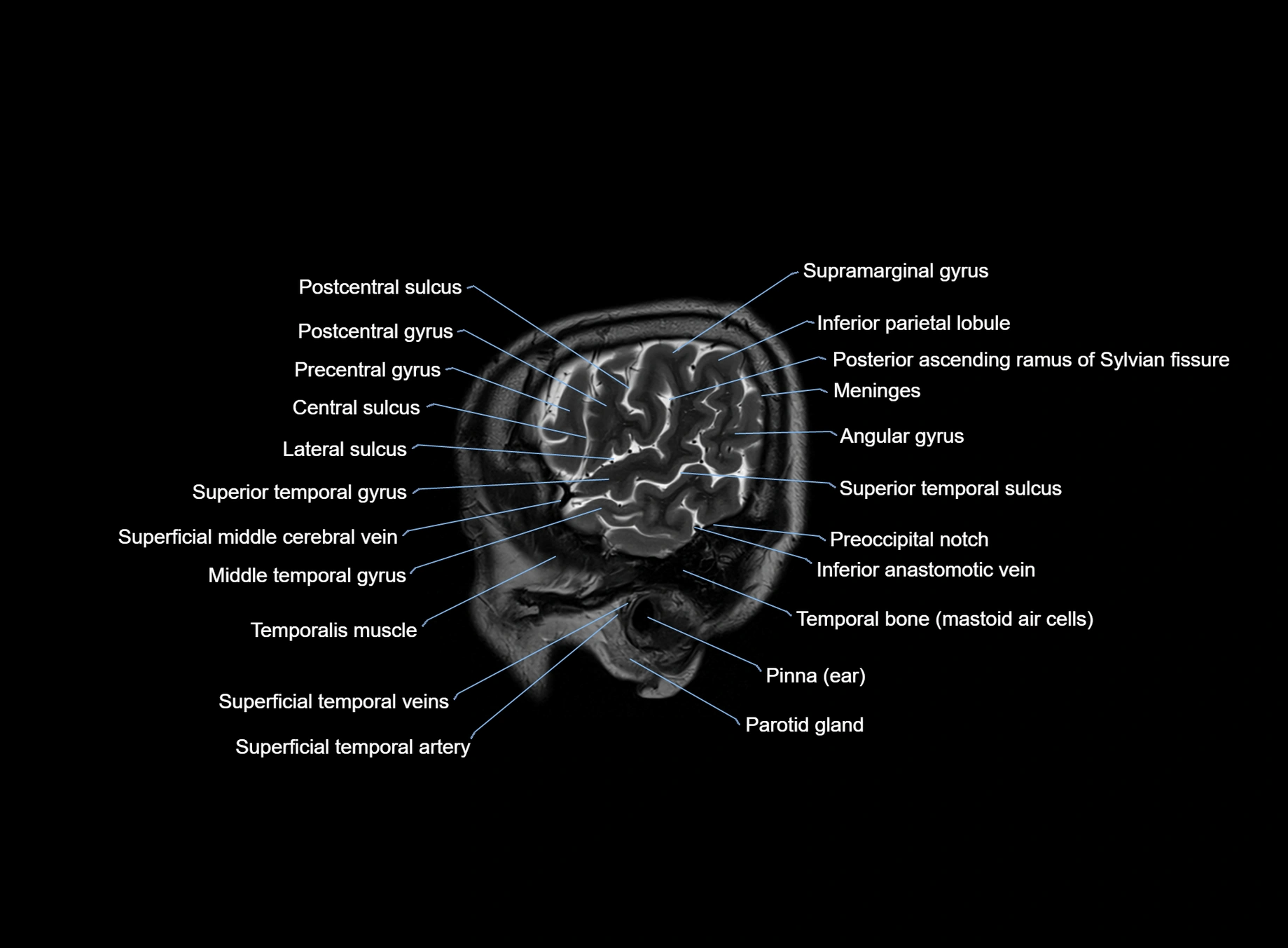 brain sagittal anatomy 3T MRI images -img-00001-00008.webp